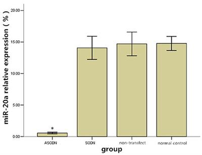 The Effects of Antisense miRNA-20a Alone or in Combination with Imatinib on K562 Cell Proliferation